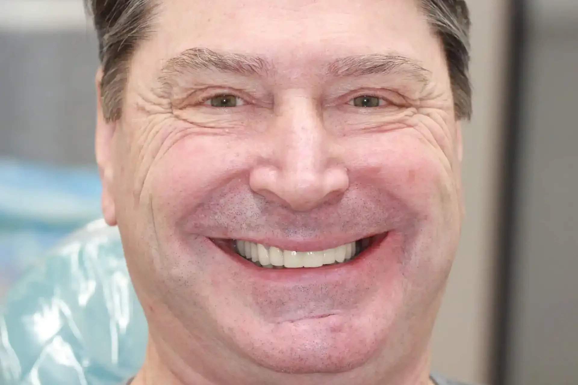 fouth-mouth-after-01