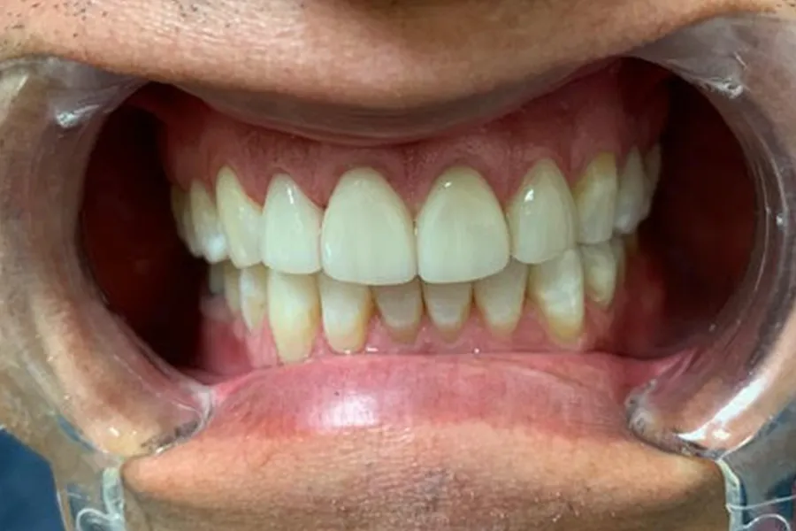 Alfredo After Cropped