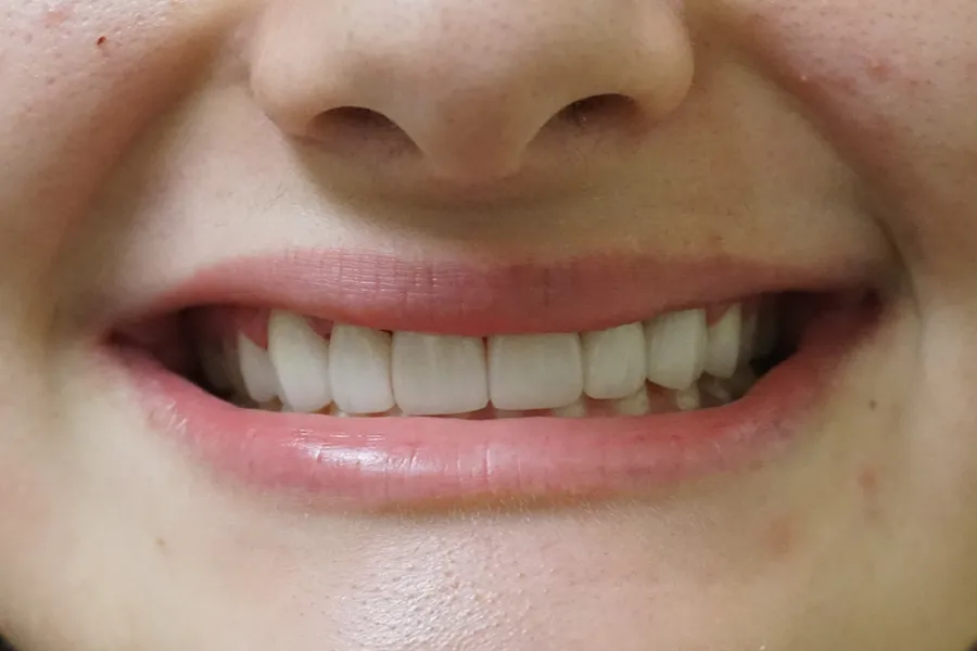 Micelle After Cropped