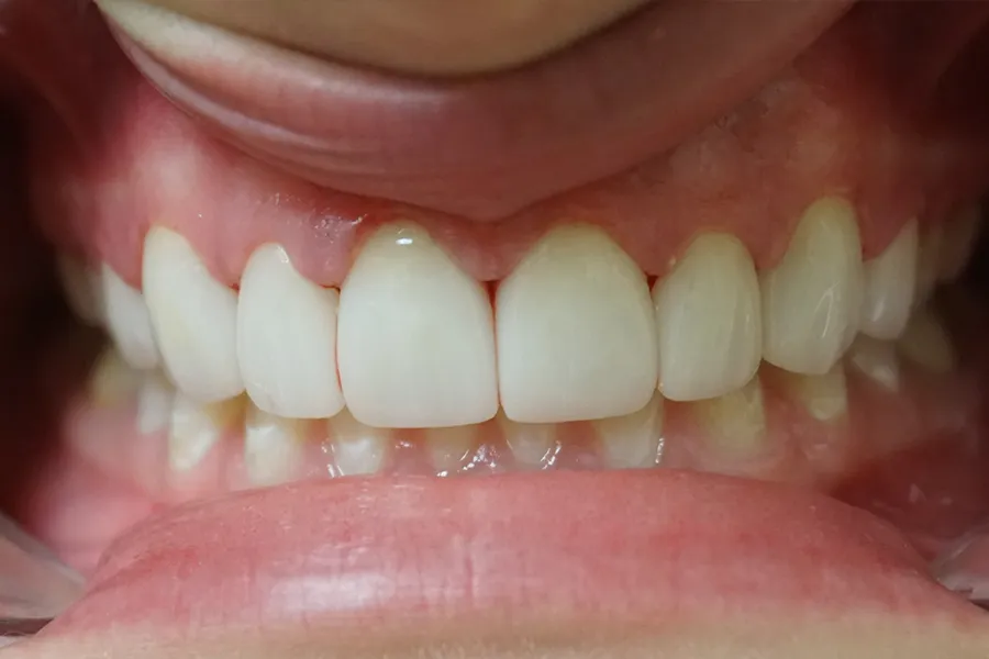 Michele 2 Afer Cropped