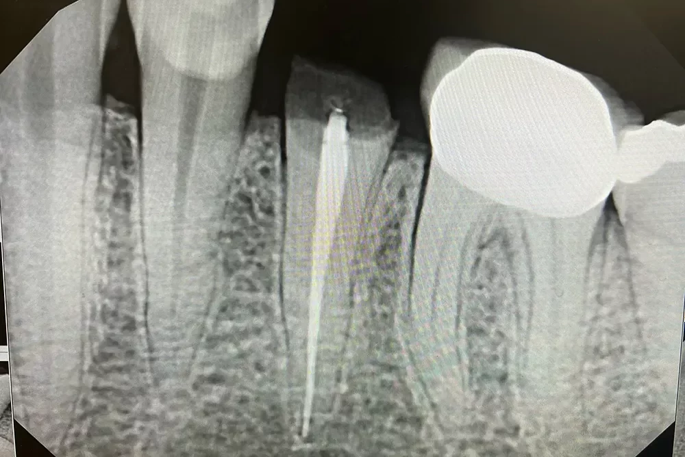 xray_before-image1 (5)